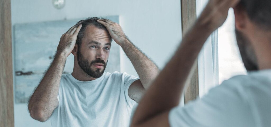 hair loss in a man