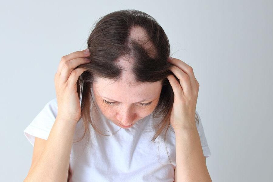 lysienie plackowate u kobiety