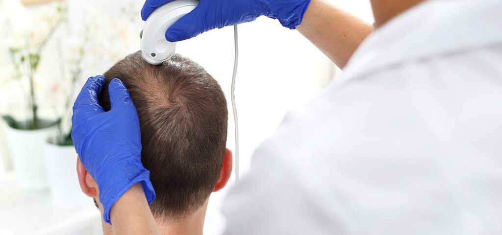 trychologia badanie trichoskopowe