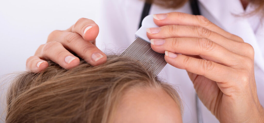 What causes hair loss in children and teenagers?