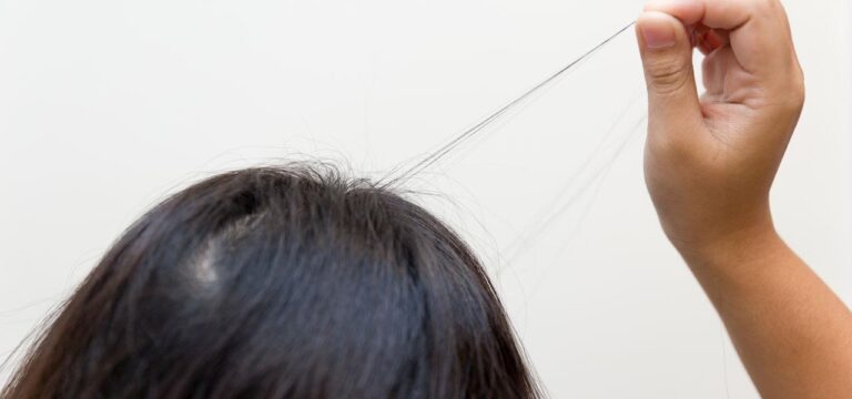 Trichotillomania