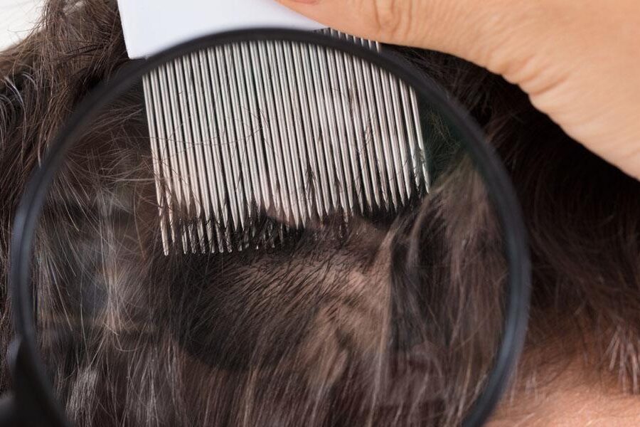 choroby skóry głowy