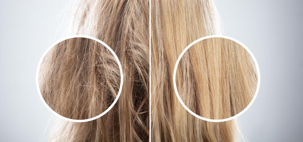 15 Things People With Brittle Hair Absolutely Swear By