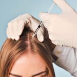 Scalp Mesotherapy