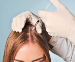 mesotherapy of the scalp