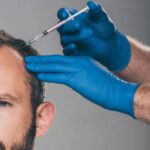 Platelet-rich plasma for hair (PRP)