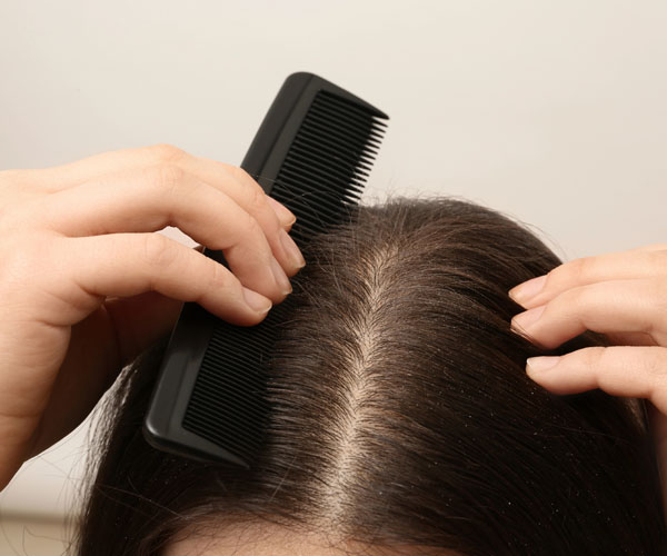 Trichological scalp peeling