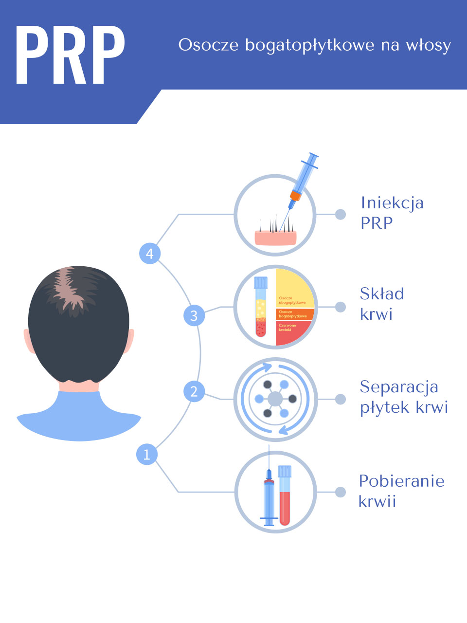 przebieg zabiegu osocze prp na wlosy