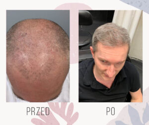 TVN Życie bez wstydu