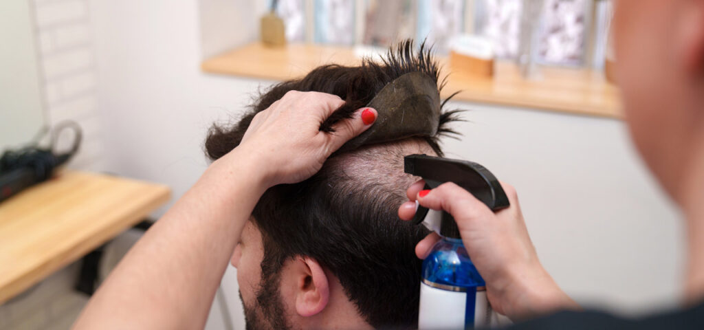 system wlosow hair systems system wlosow hair systems