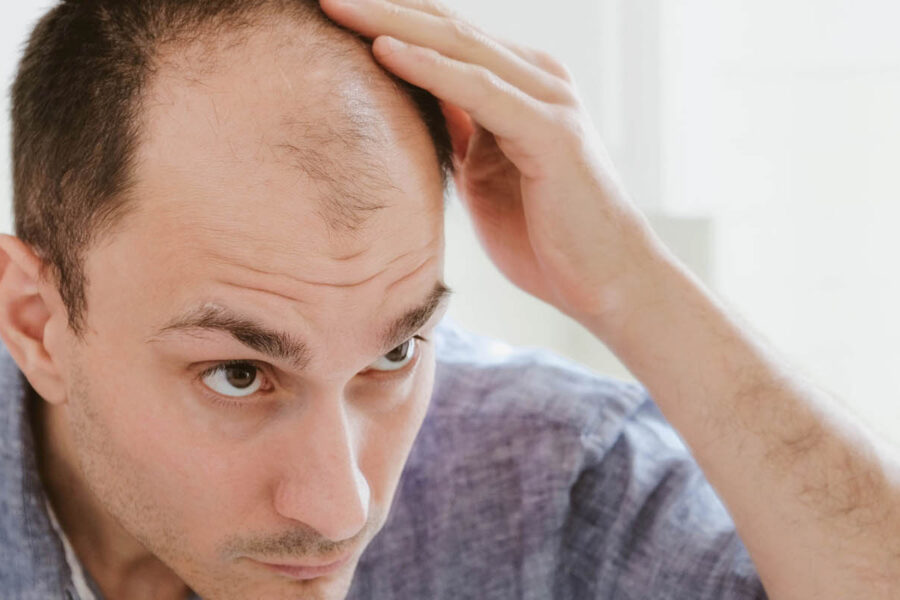 jak uniknąć nieudanego przeszczepu włosów