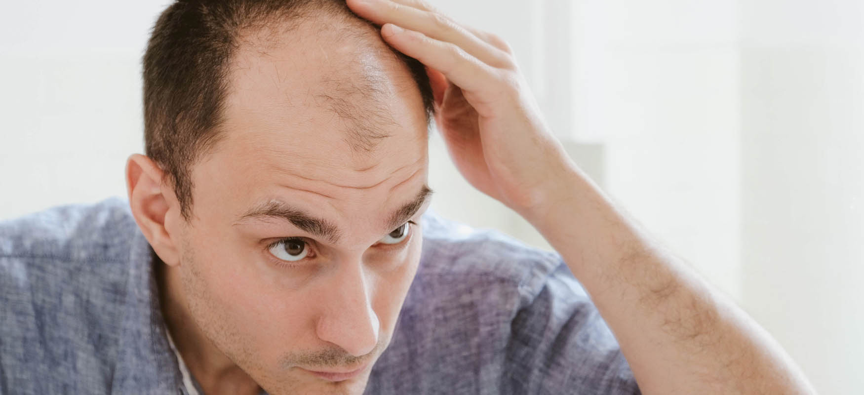 jak uniknąć nieudanego przeszczepu włosów