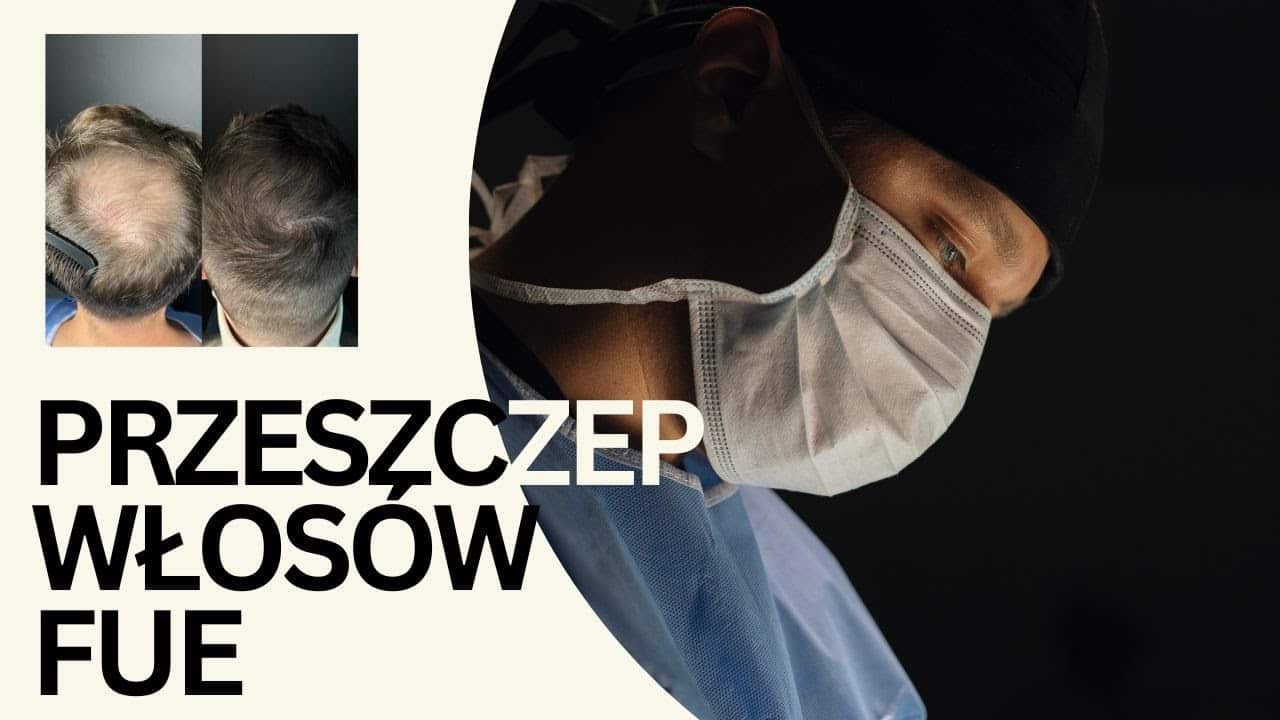transplantacja wlosow