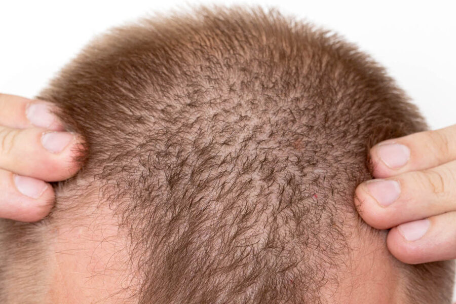 efekt działania dht