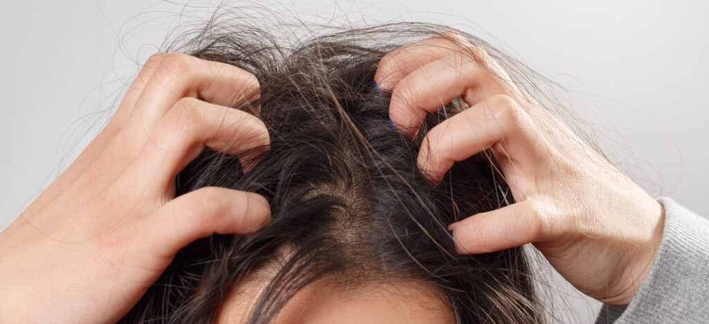 Itchy scalp: What causes unpleasant symptoms?