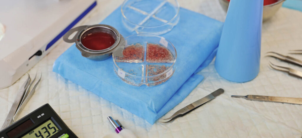 What are grafts and what is their recovery like?