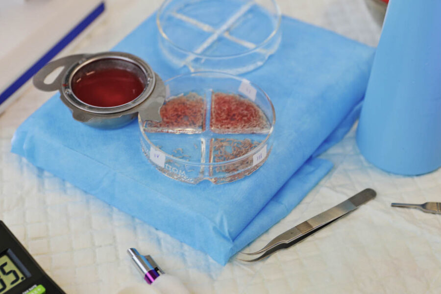 Zbliżenie na grafty włosowe przygotowane do przeszczepu włosów