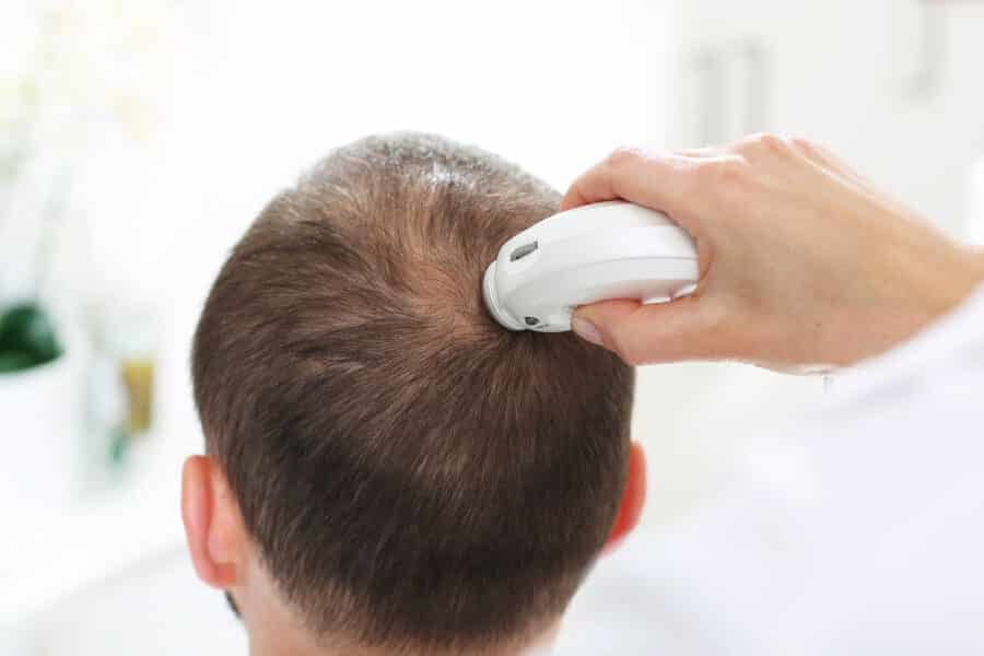 badanie wlosow skory glowy