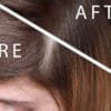 woman before after trichological treatment effects