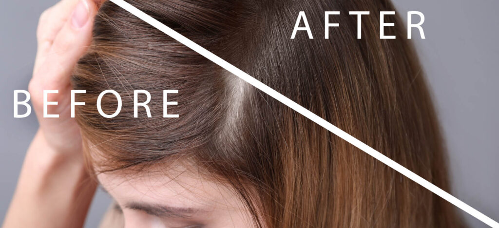 woman before after trichological treatment effects