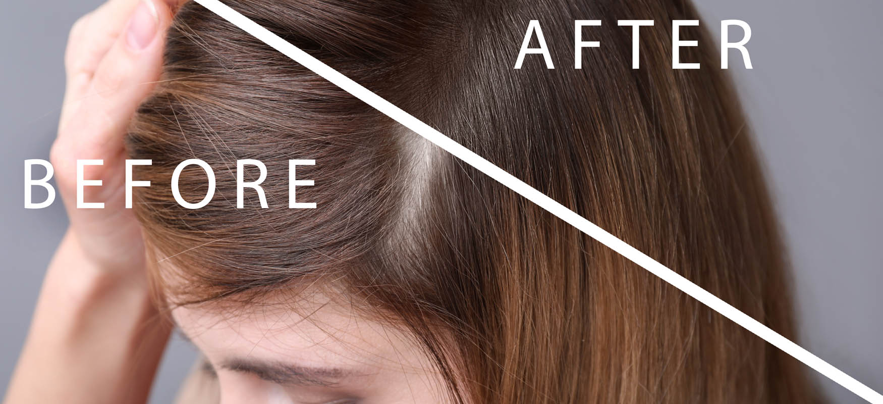 kobieta przed po leczenie trychologiczne efekty