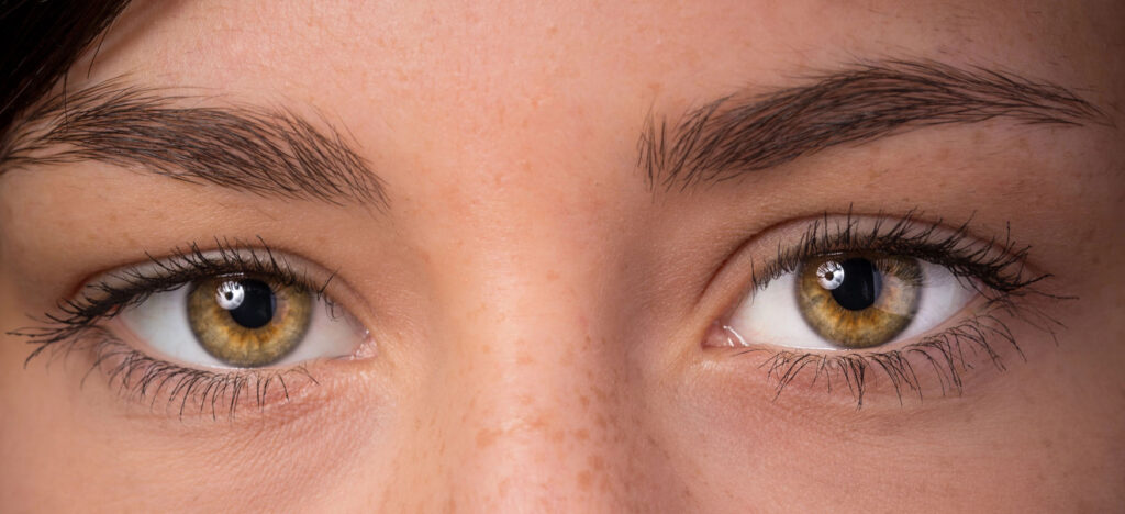 Eyelash and eyebrow loss – not just an aesthetic problem