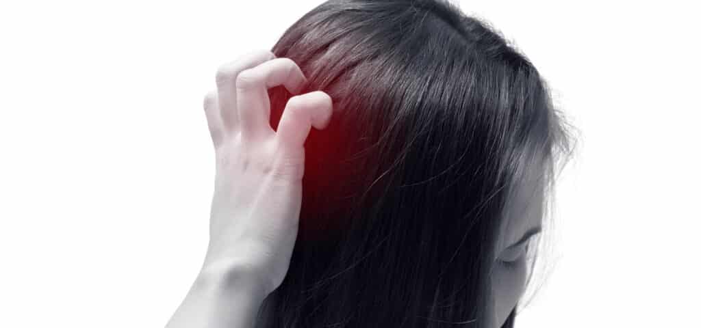 scalp and hair pain