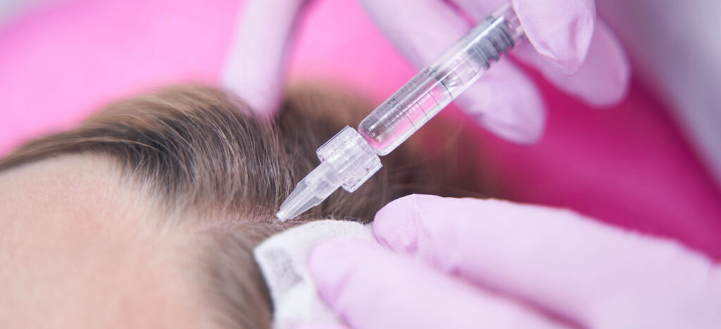Scalp mesotherapy effects – how long does it take? How to maintain them?