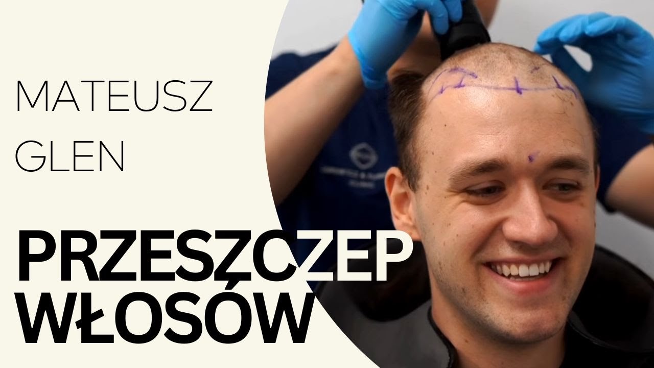 mateusz glen przeszczep